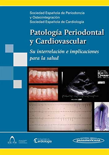 Libro Patología Periodontal Y Cardiovascular De Sociedad Esp