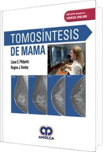 Tomosíntesis De Mama . Philpotts