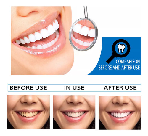 EssĂȘncia Branqueadora De Dentes, Limpeza E Higiene Bucal, R