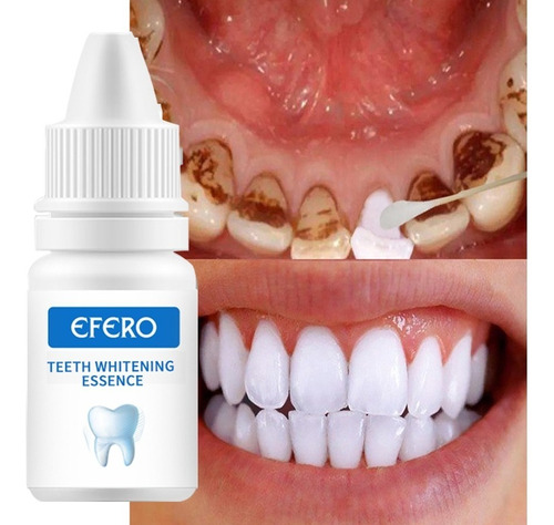 Essência Branqueadora De Dentes Efero Limpeza Higiene Oral R