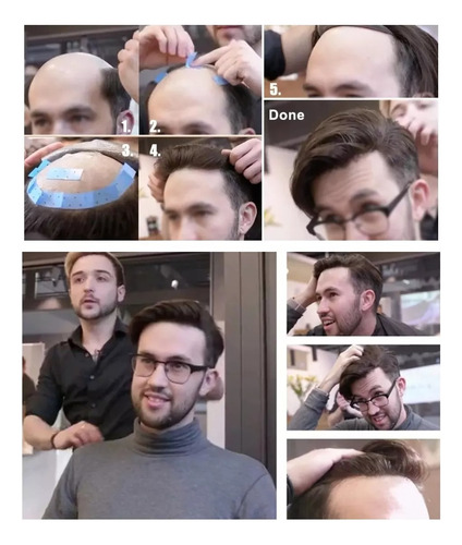 Tupé Hombre Y Mujer De Cabello Natural 100% Humano