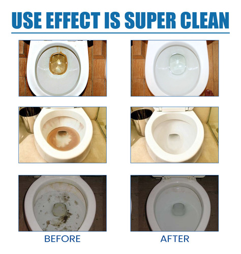 Limpador Automático De Vasos Sanitários Limpeza De Vasos San