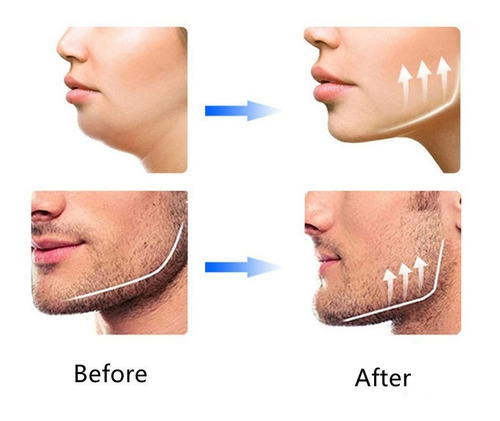 Exercitador Muscular M Ball Jaw Line De 5 Peças