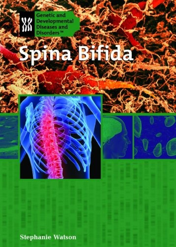 Spina Bifida (genetic And Developmental Diseases And Disorde
