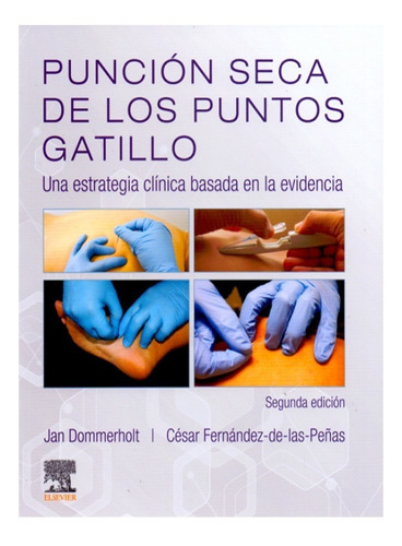 Punción Seca De Los Puntos Gatillo 2da Edicion