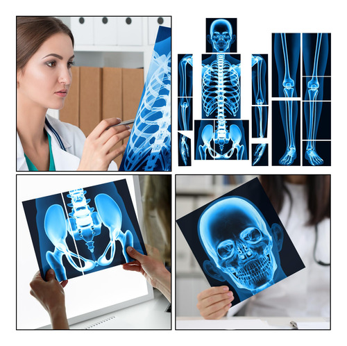 16 Piezas Rayos X Humanos Lineshading Azul Para Niños