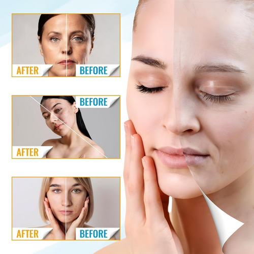 Máscara Facial, Máscara Para El Cuidado De La Piel, Máscara