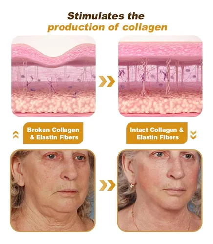 Crema Formula Antiaging Botox Bee Venom +hialuronico Lifting