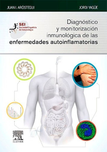 Diagnóstico Monitorización Inmunológica Enf Autoinflamatoria