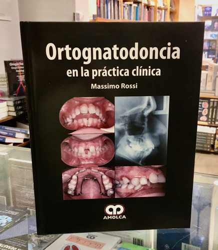 Ortognatodoncia En La Práctica Clínica