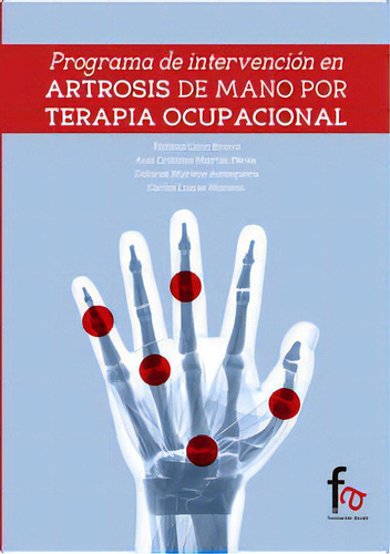 Programa De Intervencion En Artrosis De Manos Por Terapia Ocupacional, De Martin Peres, Ana Cristina. Editorial Formacion Alcala, Tapa Blanda En Español