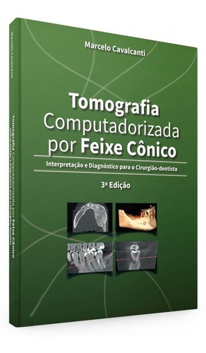 Livro Tomografia Computadorizada Por Feixe Cônico