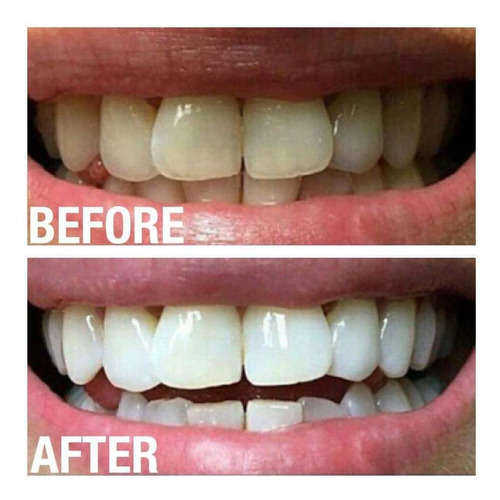 Pasta De Dientes Desmanchadora Coreana