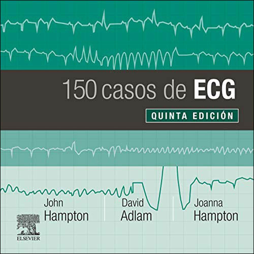 150 Casos De Ecg - Hampton - Elsevier