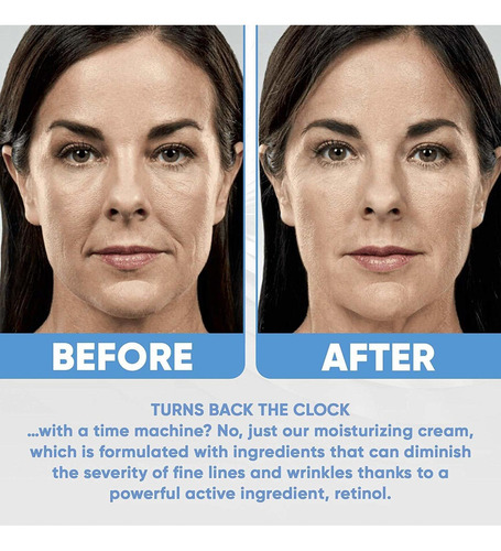 Día Y Noche Retinol Crema Hidratante Para El Rostro Con Ácid