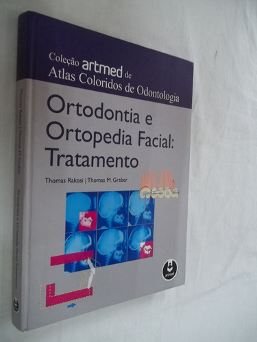 Livro - Ortodontia E Ortopedia Facial: Tratamento  - Outlet