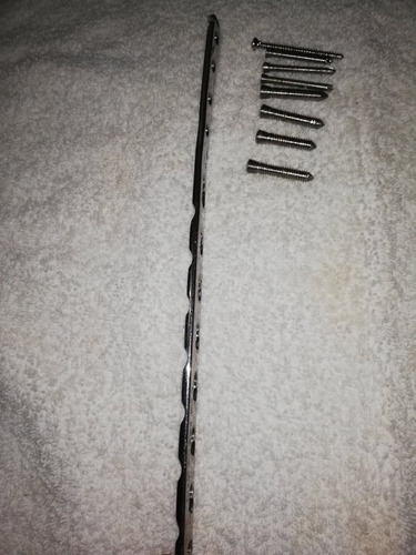 Imagen 2 de 3 de Platina De Titanio Para Fractura De Tibia Y Perones Tornillo