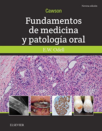 Cawson Fundamentos De Medicina Y Patologia Oral - Odell E W 