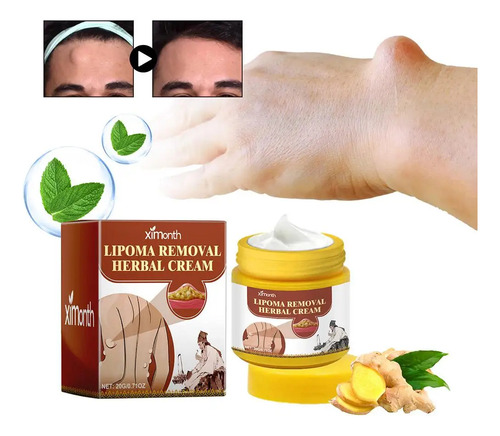Crema Para Eliminar Bultos Subcutáneos Lipoma Cream, 20 G