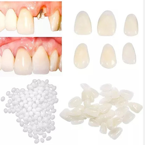 Kit 5 Dientes Provisorio Postizo Reemplaza Dentadura