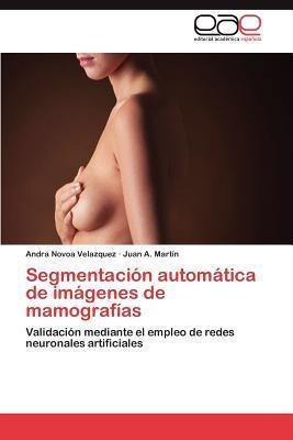 Segmentacion Automatica De Imagenes De Mamografias - Novo...