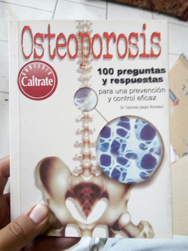 Osteoporosis 100 Preguntas. Y Otros