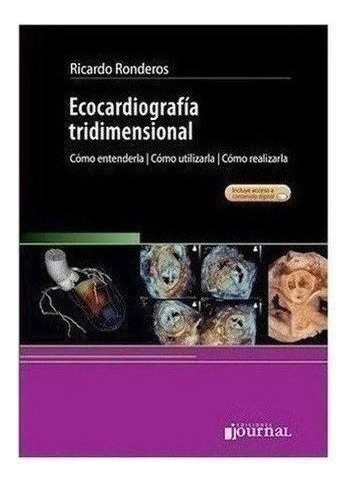Ecocardiografía Tridimensional - Ronderos, Ricardo (papel)