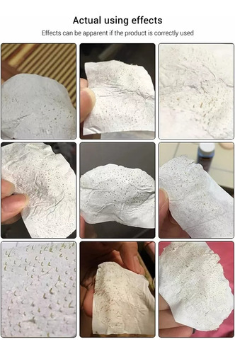 2 Cremas Mágica Quita Puntos Negros Lanbena Nariz 120 Tiras Normal Día/noche