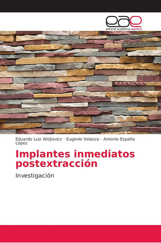 Libro: Implantes Inmediatos Postextracción: Investigación (s