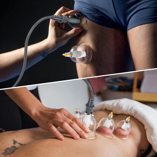 Set De Ventosas Muchoo Professional Chinese Acupoint Cupping