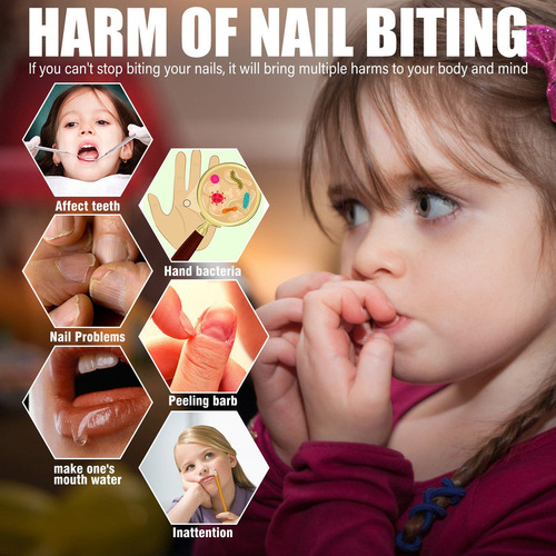 Tratamiento Para Morderse Las Uñas Para Niños Y Dejar De Chu