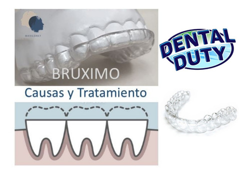Placa Termomoldeable Bruxismo Agnovedades