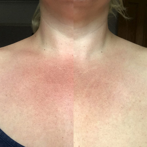 My Instant Effects Neck And Chest Rejuvenating Serum For Wom