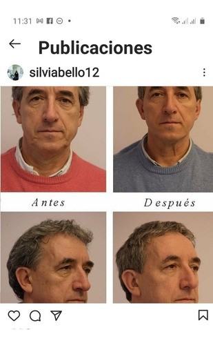 Imagen 3 de 3 de Hilos Tensores