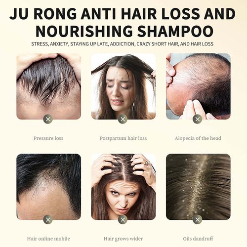 Um Shampoo T Com Extrato Vegetal De Gengibre Para O