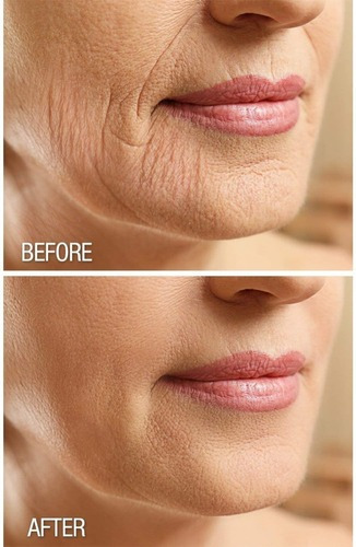 Crema Reafirmante Y Exfoliante Para El Cuerpo Dermactin Frutal Suave Botella Todas