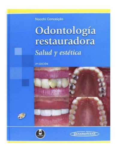 Odontologia Restauradora. Salud Y Estetica