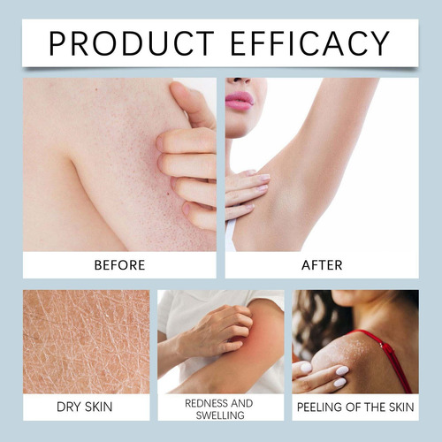 La Loción Corporal C Proporciona Nutrición, Sequedad, Opacid