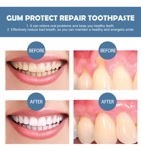 Reparação De Dentes, Manchas, Gengivas, Branqueamento De Den