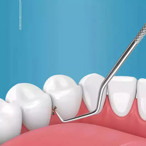 Js Kit Portátil De Blanqueamiento Dental Para El Cuidado