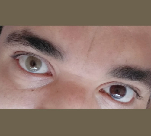 Siesta Black Sugar Brown Lentes De Contacto