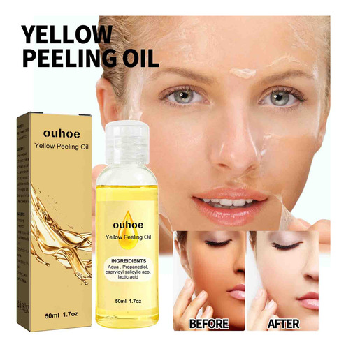 Manchas De Clareamento: 50 Ml, Removendo Esfoliantes, Clarea