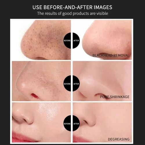 Mascarilla Facial Puntos Negros X20 Unidad Limpieza Belleza