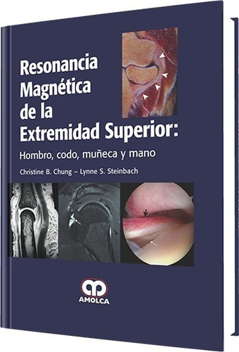 Resonancia Magnética De La Extremidad Superior, De Christine B. Chung Y S., Vol. 1. Editorial Amolca, Tapa Dura En Español, 2014