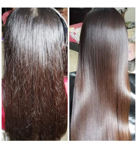 Cirugia Capilar Celulas Madres Litro K - L a $44000