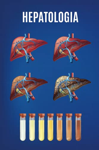 Cuaderno De Hepatologia: 120 Paginas