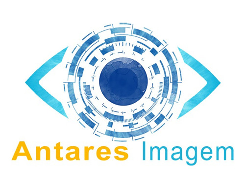 Lentes De Contato Air Optix Plus Hydraglyde