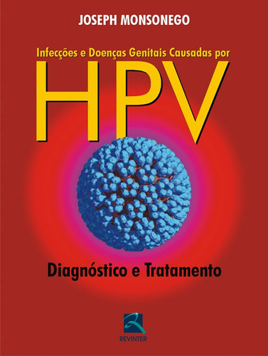 Infecções e Doenças Genitais Causadas por HPV: Diagnóstico e Tratamento, de Monsonego, Joseph. Editora Thieme Revinter Publicações Ltda, capa dura em português, 2009