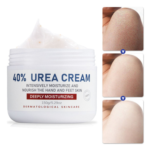 Crema Con Urea Para Pies Con Urea Para Pies, 40 Percgjh