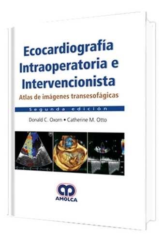 Ecocardiografía Intraoperatoria E Intervencionista. Amolca 